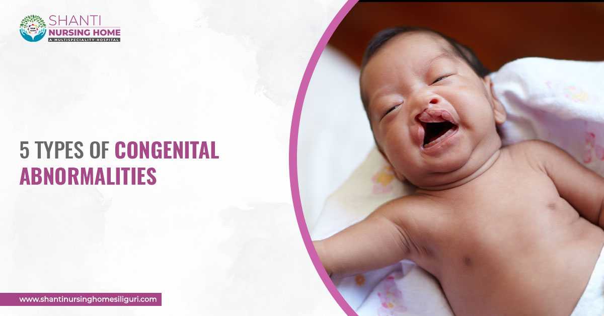 5 Types Of Congenital Abnormalities