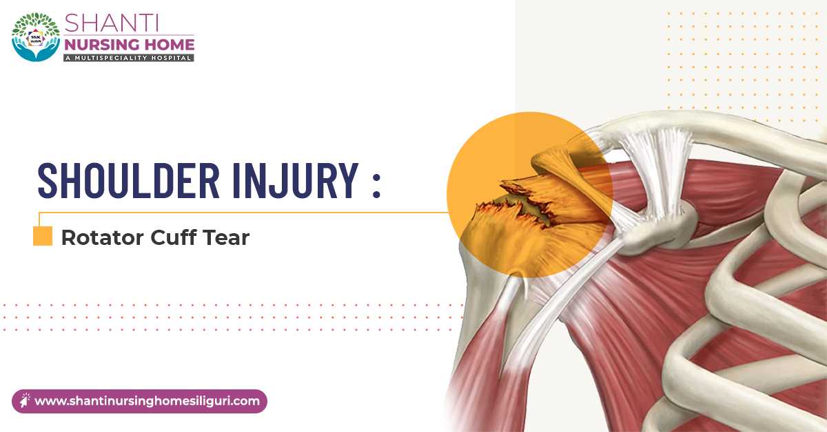 Shoulder Injury: Rotator Cuff Tear