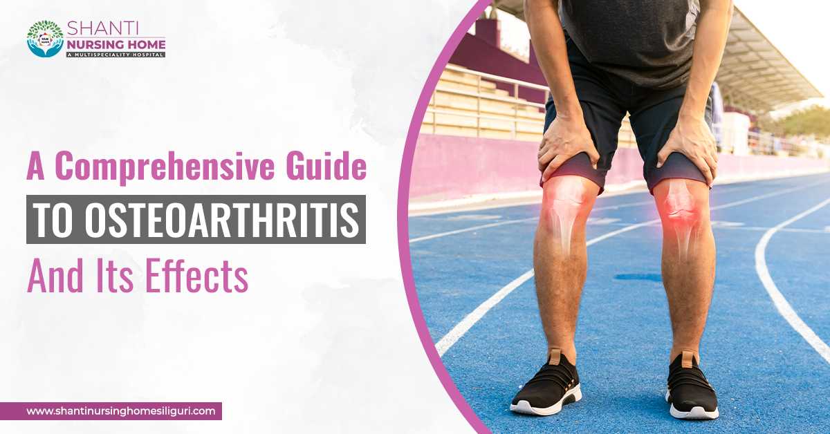 A Comprehensive Guide To Osteoarthritis And Its Effects