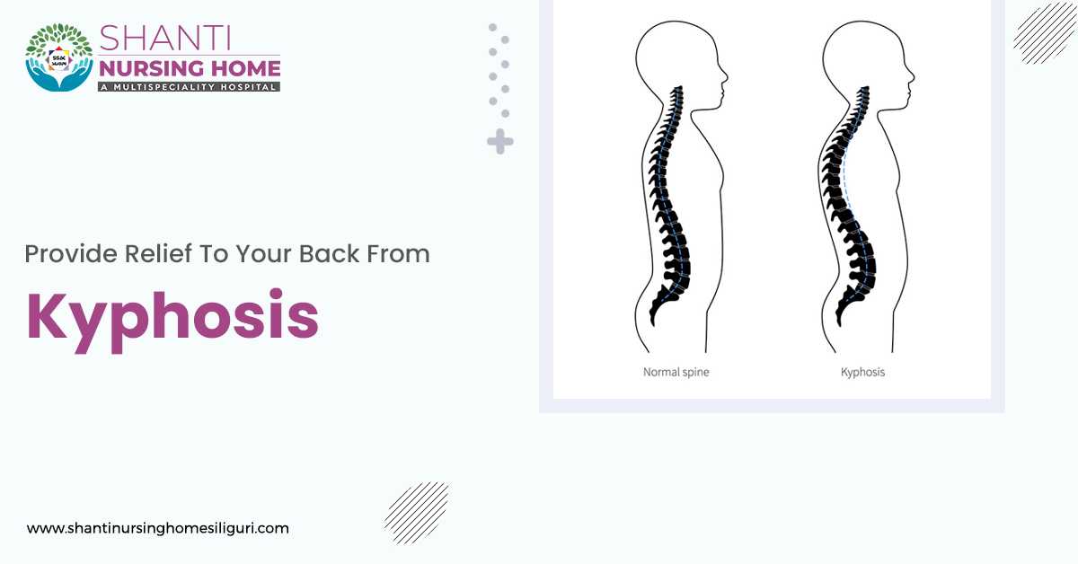 Treat Your Kyphosis with best Orthopaedic Surgery