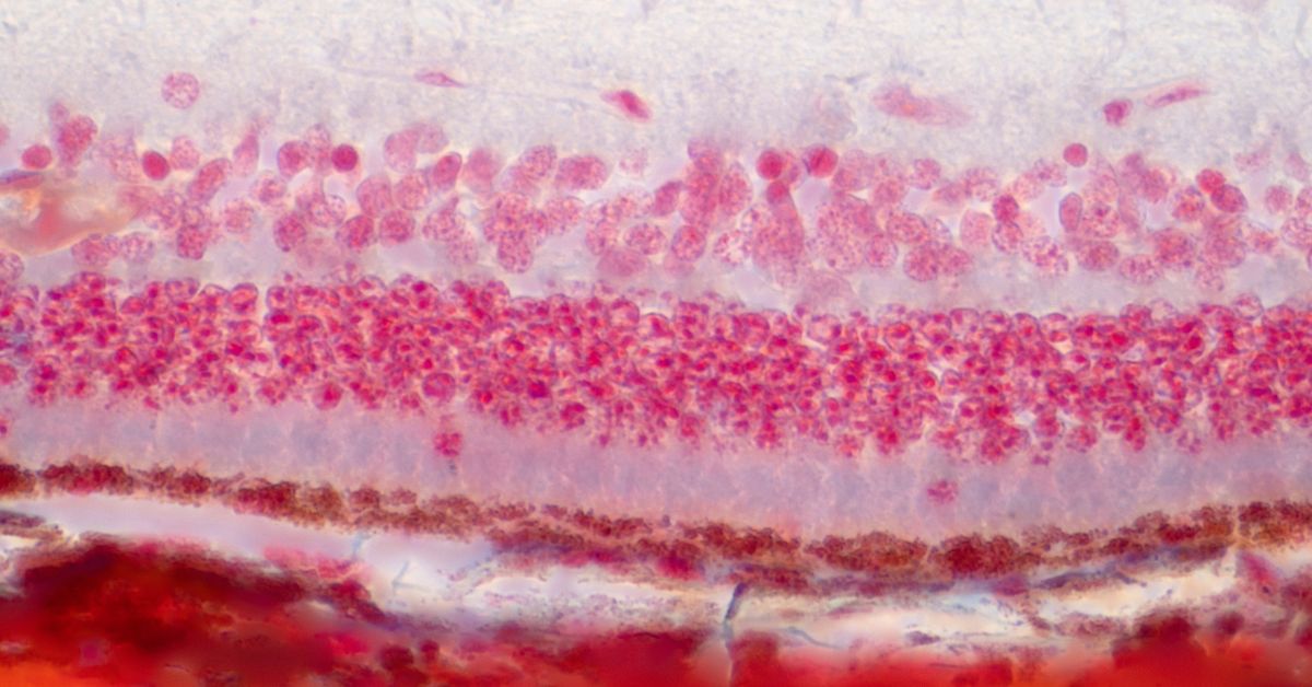 tissue repair