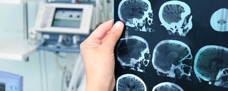 Neurosurgeon in Siliguri Neurosurgeon in Siliguri